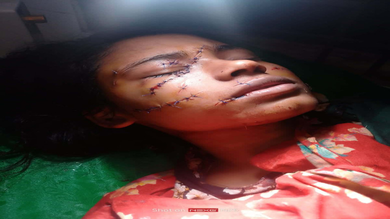 নড়াইলের নড়াগাতিতে  ব্লেড দিয়ে ক্ষত-বিক্ষত করে স্ত্রীকে হত্যা চেষ্টার অভিযোগ স্বামীর বিরুদ্ধে