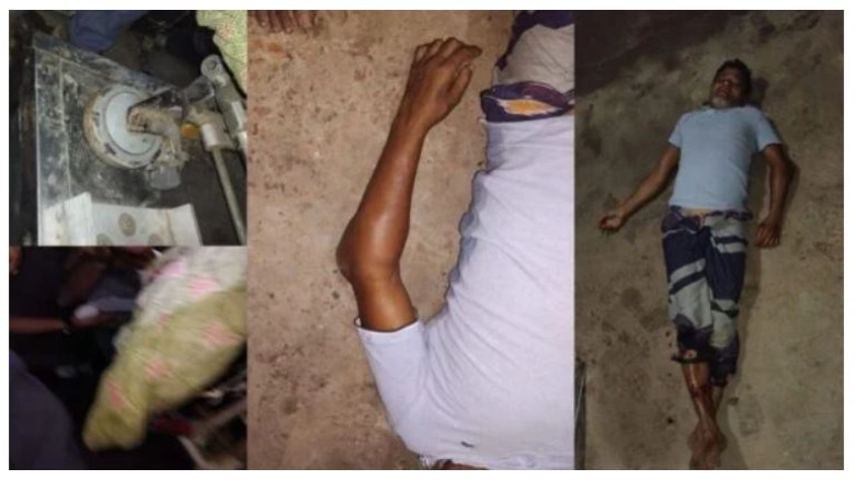 বরিশালে কুড়াল ও ধারালো অস্ত্র দিয়ে এক ব্যক্তিকে নৃশংস হামলার অভিযোগ